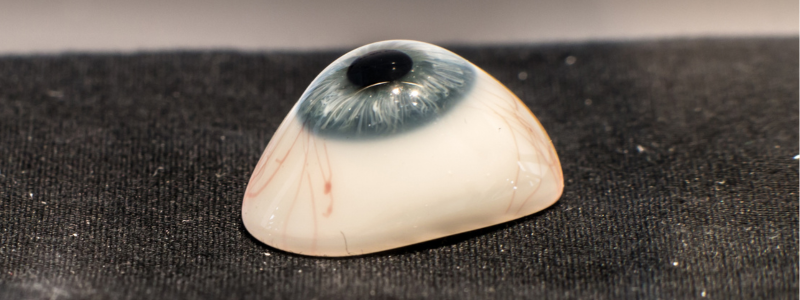 Prótesis ocular