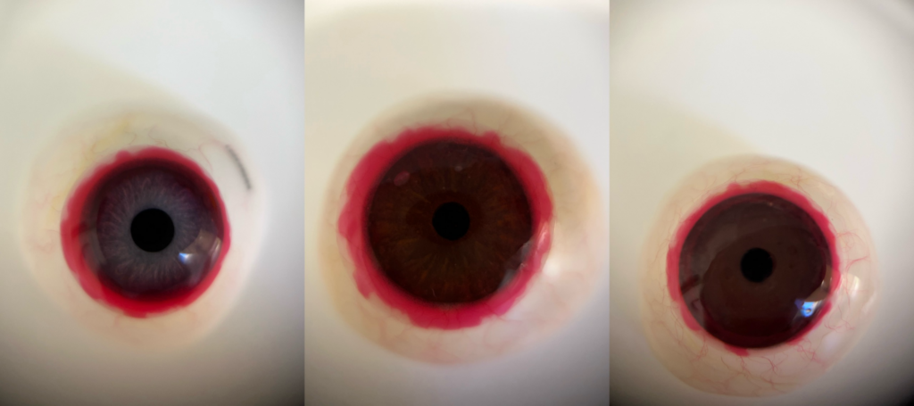 Prótesis de ojos realistas con detalles de sangre alrededor del iris para maquillaje de efectos especiales.